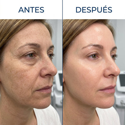 Lumina™ · Sistema Avanzado de Fototerapia y Rejuvenecimiento Facial LED